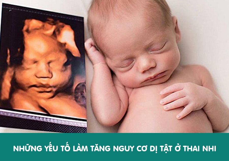 Nhung-yeu-to-lam-tang-nguy-co-di-tat-o-thai-nhi